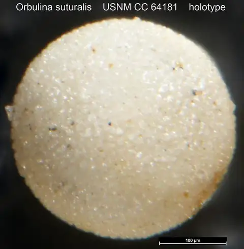 Dokumentasi USNM CC64181 dengan identifikasi pada sumber Orbulina suturalis. Isi dan label gambar dipertahankan.
