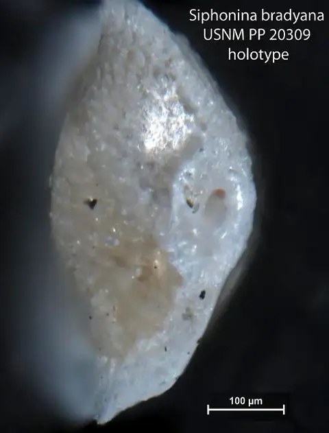 Dokumentasi USNM PP20309 dengan identifikasi pada sumber Siphonina bradyana. Isi dan label gambar dipertahankan.