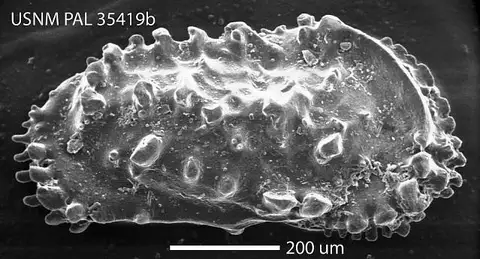 Dokumentasi USNM PAL35419B dengan identifikasi pada sumber Actinocythereis exanthemata. Isi dan label gambar dipertahankan.