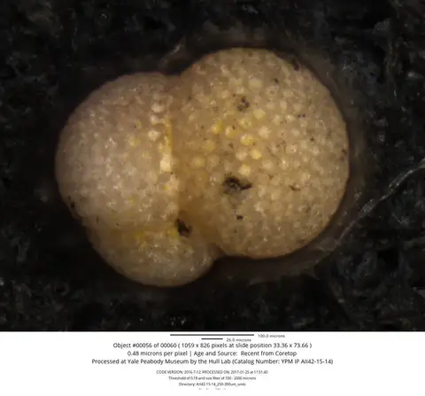 Dokumentasi YPM IP 560749 dengan identifikasi pada sumber Trilobatus sacculifer. Isi dan label gambar dipertahankan.