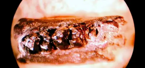 Dokumentasi USNM V15788 dengan identifikasi pada sumber Anisonchus onostus. Isi dan label gambar dipertahankan.