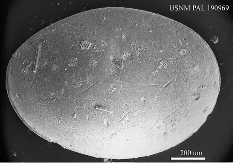 Dokumentasi USNM PAL190969 dengan identifikasi pada sumber Cytherella ovata. Isi dan label gambar dipertahankan.