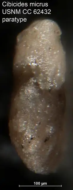 Dokumentasi USNM CC62432 dengan identifikasi pada sumber Cibicides micrus. Isi dan label gambar dipertahankan.