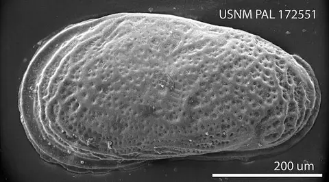 Dokumentasi USNM PAL172551 dengan identifikasi pada sumber Cytheromorpha suffolkensis. Isi dan label gambar dipertahankan.