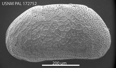 Dokumentasi USNM PAL172752 dengan identifikasi pada sumber Microcytherura expanda. Isi dan label gambar dipertahankan.